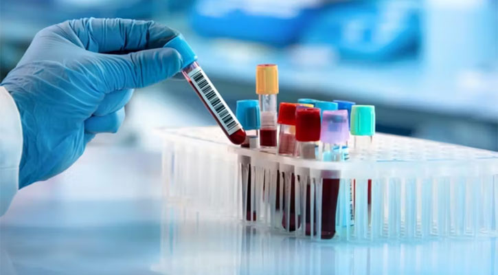 Study finds multi-cancer blood test detects 50 types