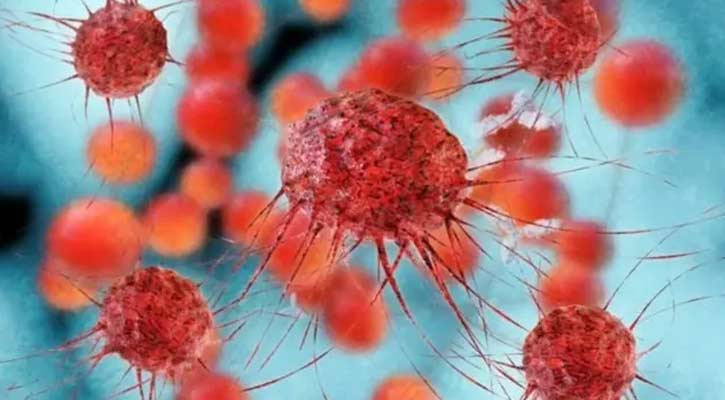 Bangladesh cancer care far below need