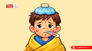 6 die with measles symptoms; 1,292 suspected cases in 24hr